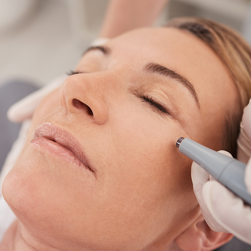 A woman receiving a micro needling treatment